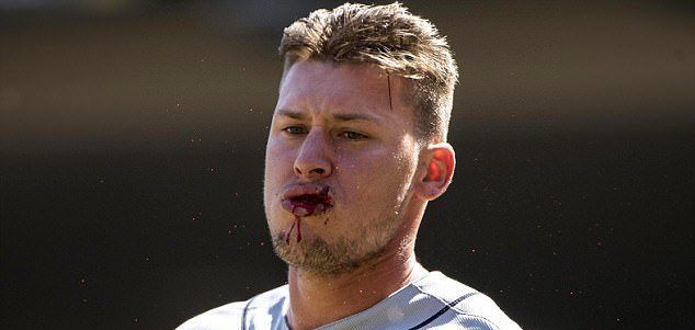 #Video Pelea entre Tigres y Mellizos