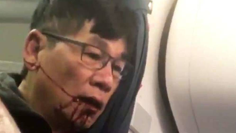 Policía asegura que pasajero de United fue agresivo