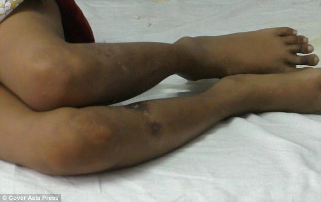 #Video Rescatan a niña viviendo con monos en bosque de India - niña-mono-5