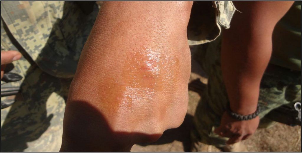 Agreden a militares que destruían plantío de amapola - oaxaca-3-1024x521