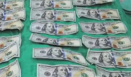 Extraen siete mil dólares del estómago de una mujer