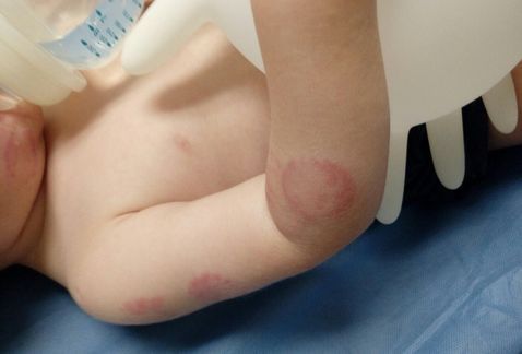 Directora de guardería admite negligencia por niño mordido 25 veces - guardería-2