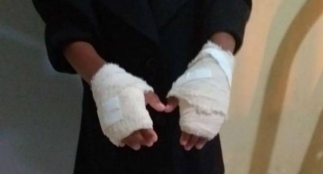 Mujer quema manos a niña de seis años por portarse mal