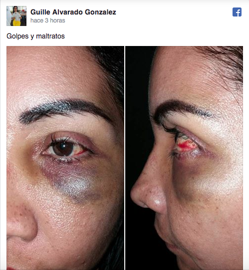 Golpean a esposa de secretario de Gobierno de Veracruz - Captura-de-pantalla-2017-06-17-a-las-2.59.41-p.m.