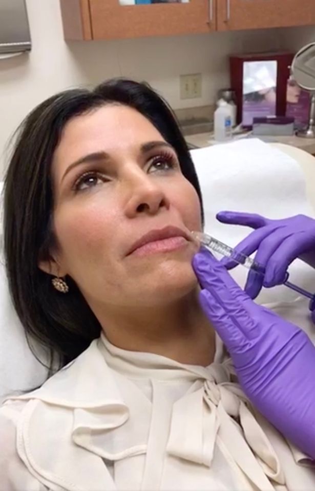 Mujer se someterá a cirugías para parecerse a Melania Trump - mujer-cirugías1