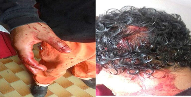 Pelea por la limpieza de la refinería de Salina Cruz deja 20 lesionados - pelea-refineria-antonio-dovali3