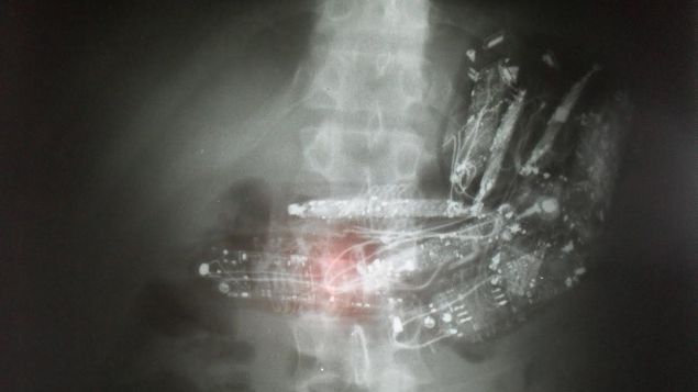 Detienen a tres presos con celulares en el estómago en Brasil - teléfonos