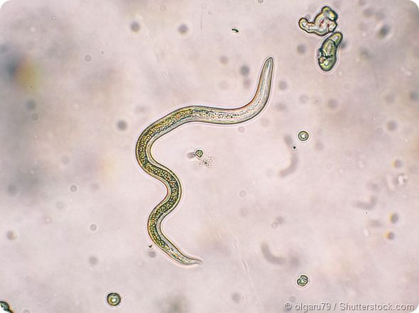 Tener contacto con mascotas sin higiene puede contagiar enfermedades - ShutterStock-Larva-Migrans