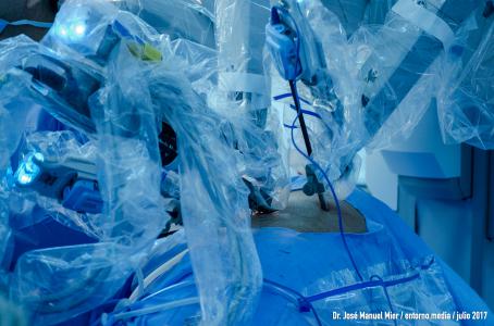 Realizan las primeras cirugías torácicas con robot en México - robot-3