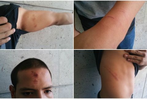 Policías de Torreón golpean a joven con bebé en brazos - violencia_torreon-policia_torreon-agresiones_policia-milenio_noticias_laguna_MILIMA20170729_0080_11