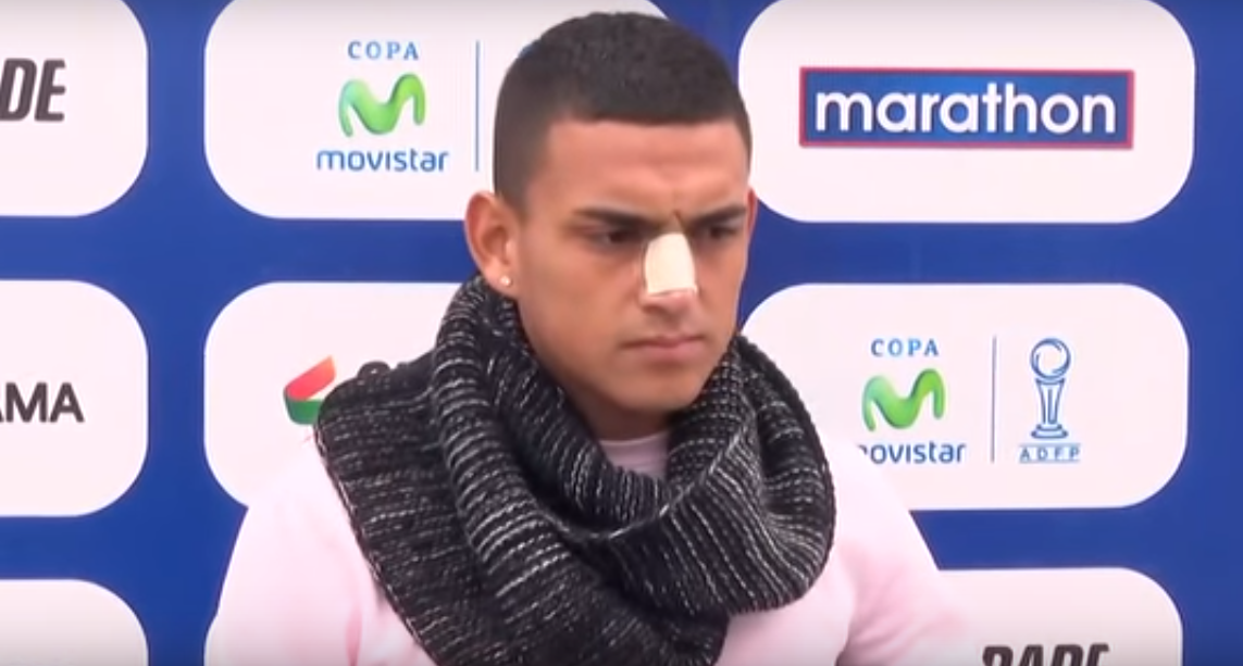 Auxiliar técnico mexicano suspendido por cabezazo en Perú - Carlos-Rabanal-Captura-de-PeruFutbol