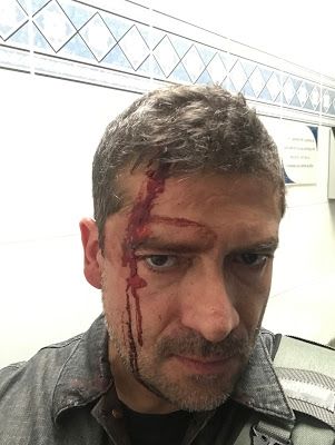 Narcomenudistas agreden a periodista en C.U. - HumbertoGolpe