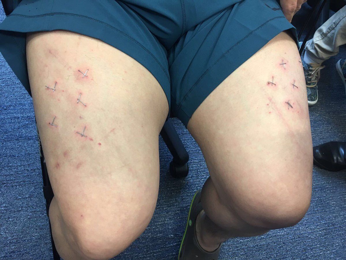 Activista de Hong Kong denuncia torturas - howard-lam-2