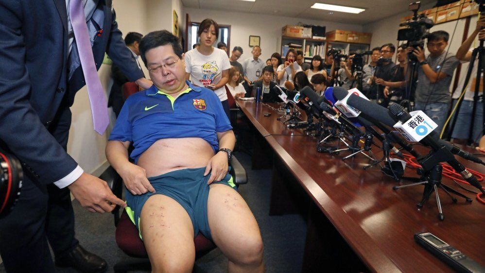 Activista de Hong Kong denuncia torturas - howard-lam