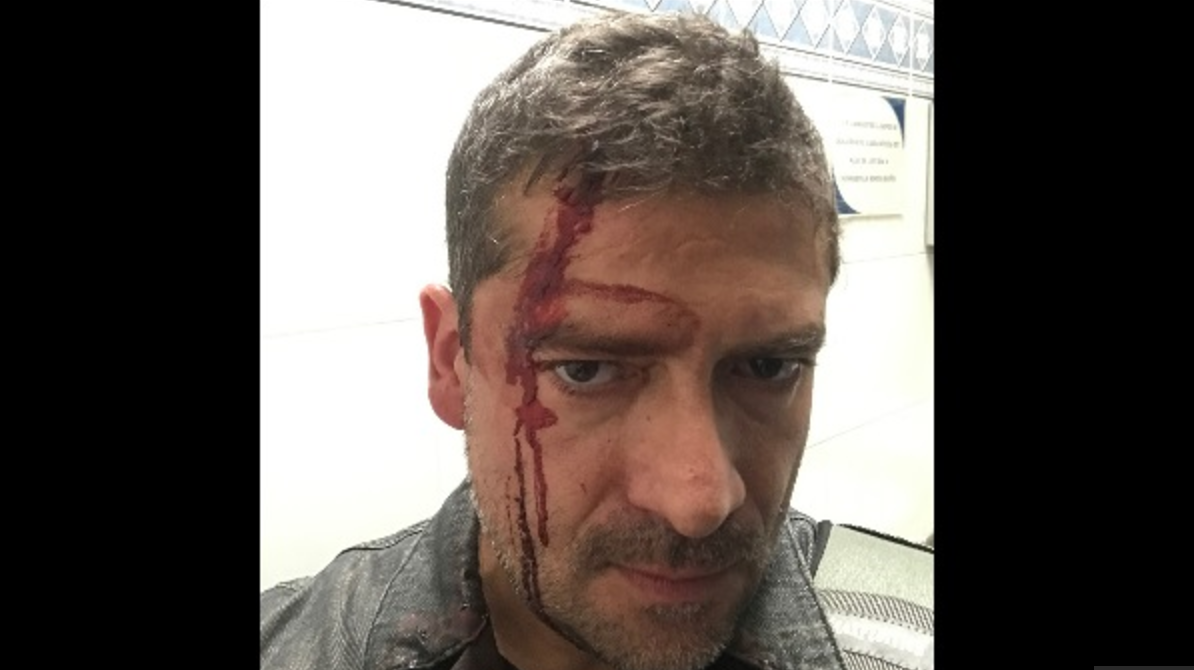 UNAM presenta denuncia tras agresión a reportero en Ciudad Universitaria