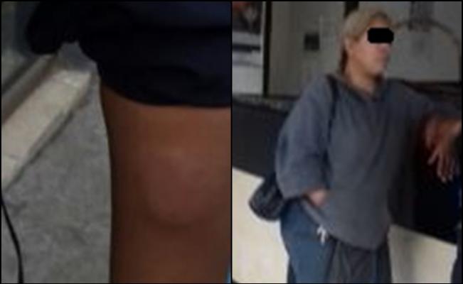 Vendedora ambulante muerde a policía capitalino