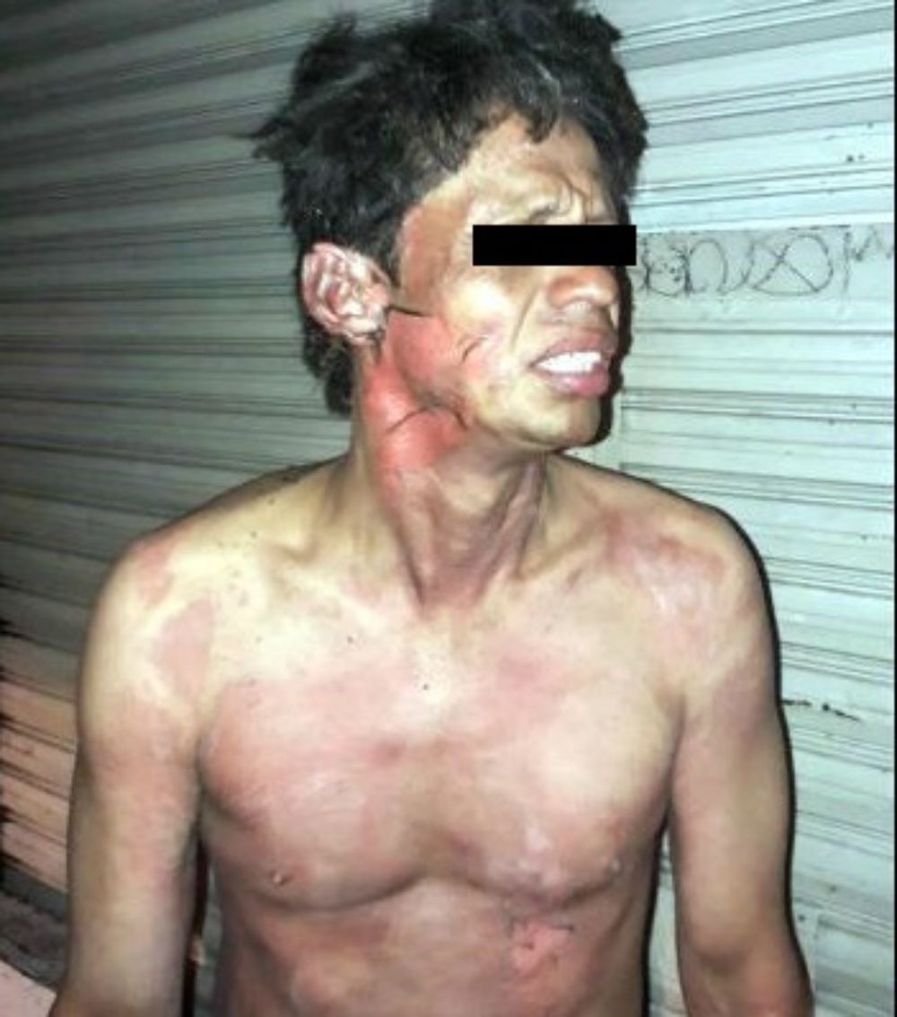 Prenden fuego a al menos tres personas cerca del Teatro Blanquita - Indigente-quemado-Foto-de-Debate