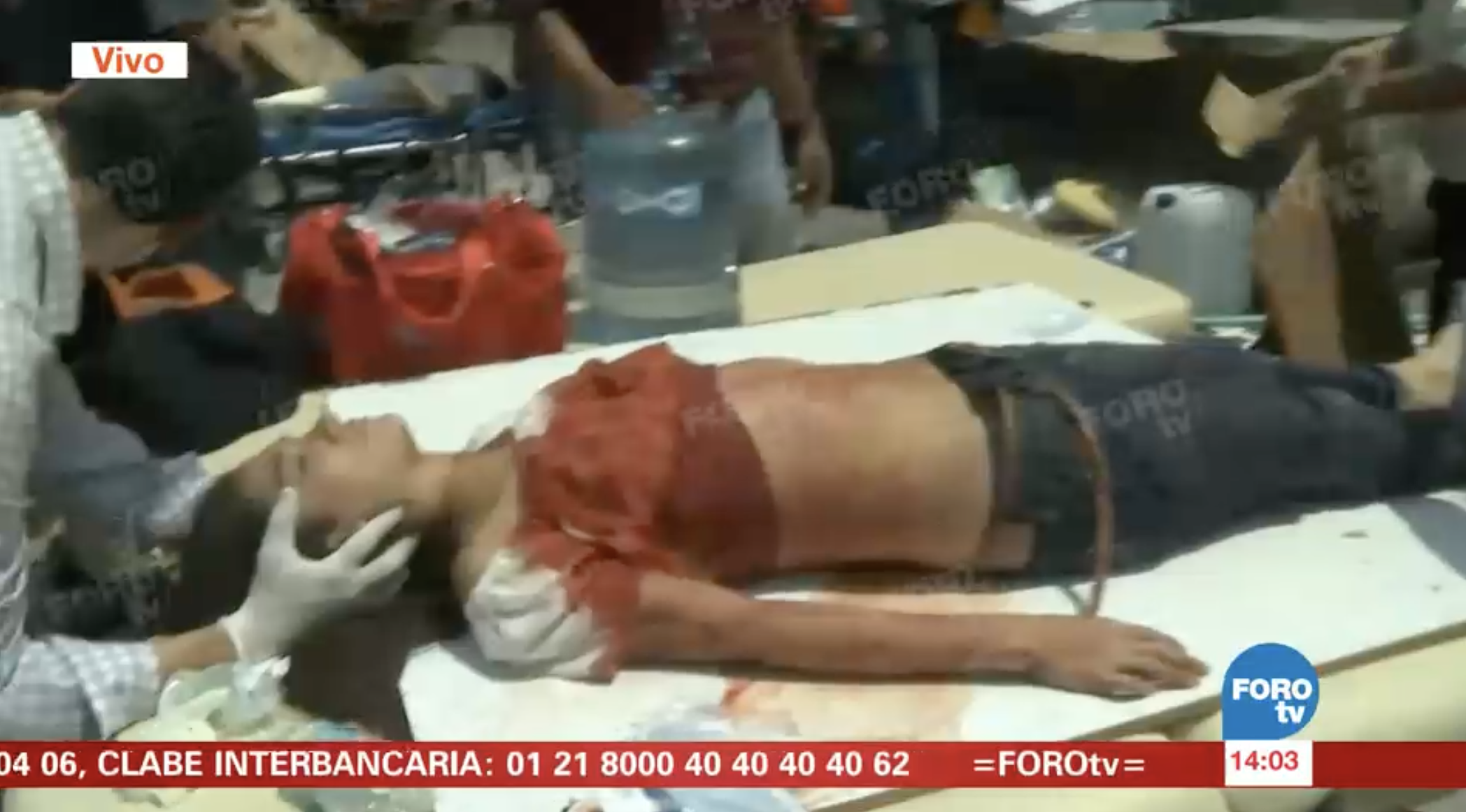 Sismo de 7.1 sacude la Ciudad de México - lesionada-sismo