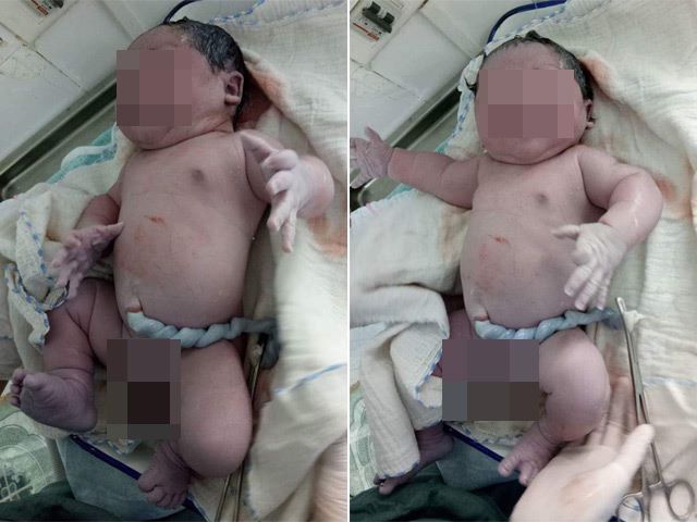 Mujer da a luz a bebé de siete kilos en Vietnam - Bebé-de-7-kilos