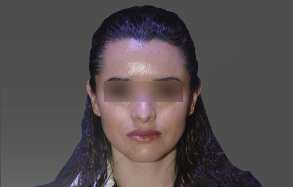 Detienen a regidora de Tenango por disparar a mujer