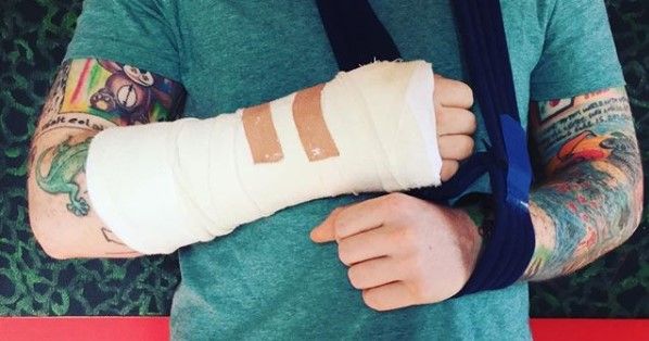 Ed Sheeran pone en riesgo su próxima gira por accidente en bicicleta Ed Sheeran pone en riesgo su próxima gira por accidente en bicicleta