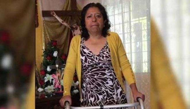 Piden videos de incidente que provocó amputación de pierna de una mujer