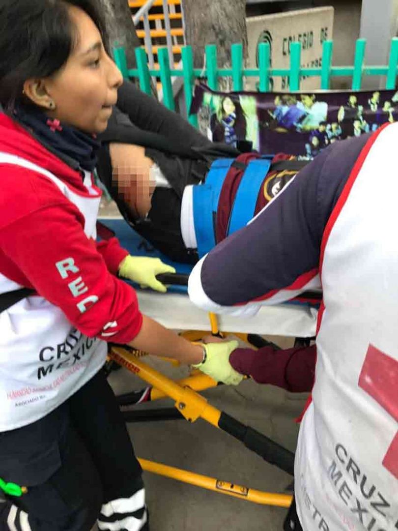 Balean a alumno en escuela de la Ciudad de México - herido