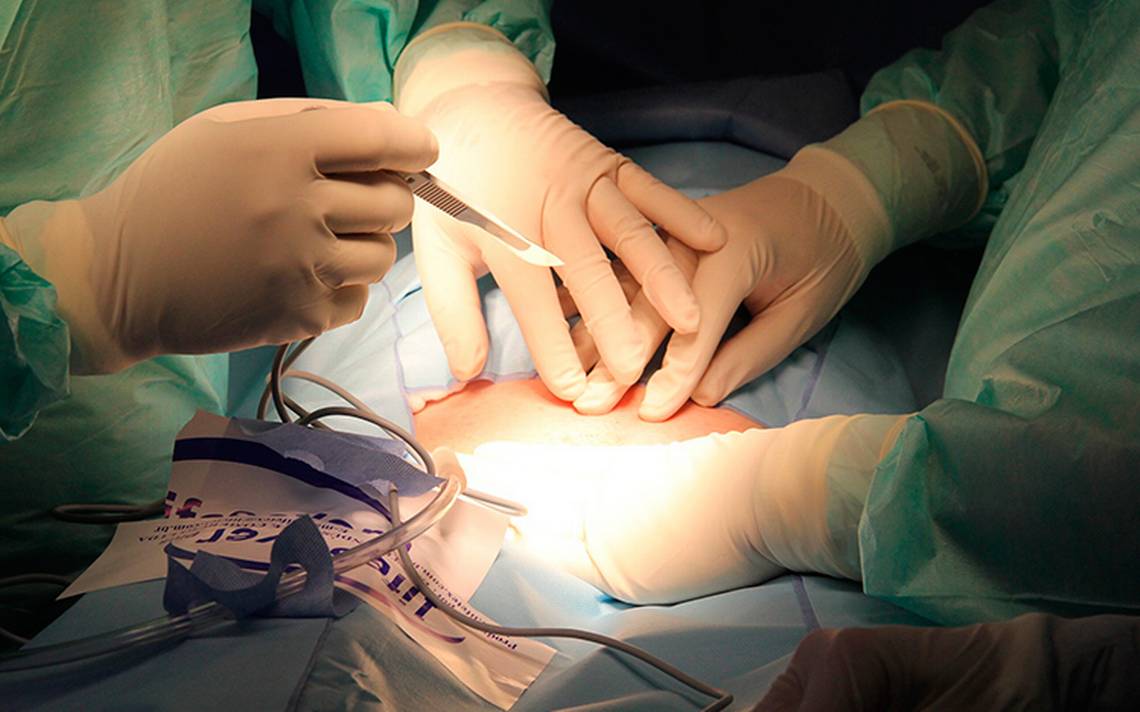 Médicos salvaron a menor al operarlo durante sismo del 19 de septiembre - operación-sismo