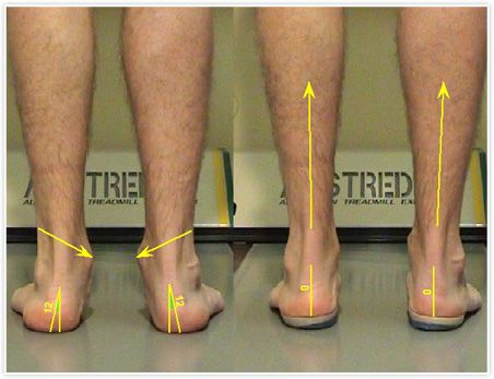 Importancia de la postura y los pies - pies-2