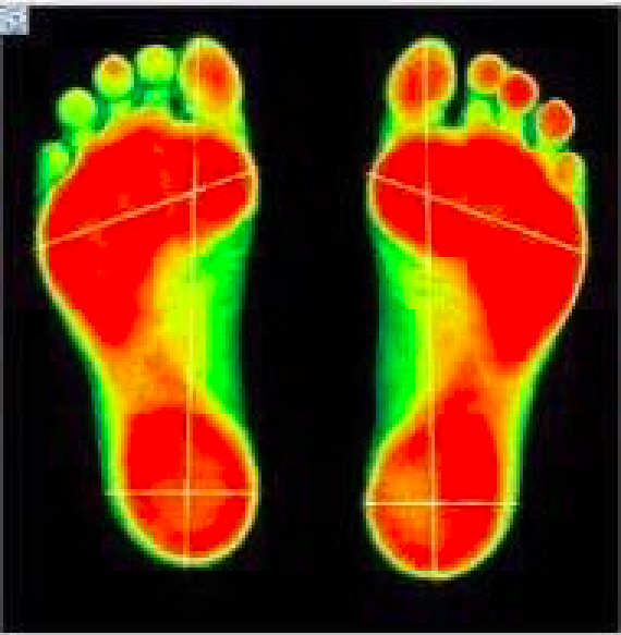 Importancia de la postura y los pies - pies-3