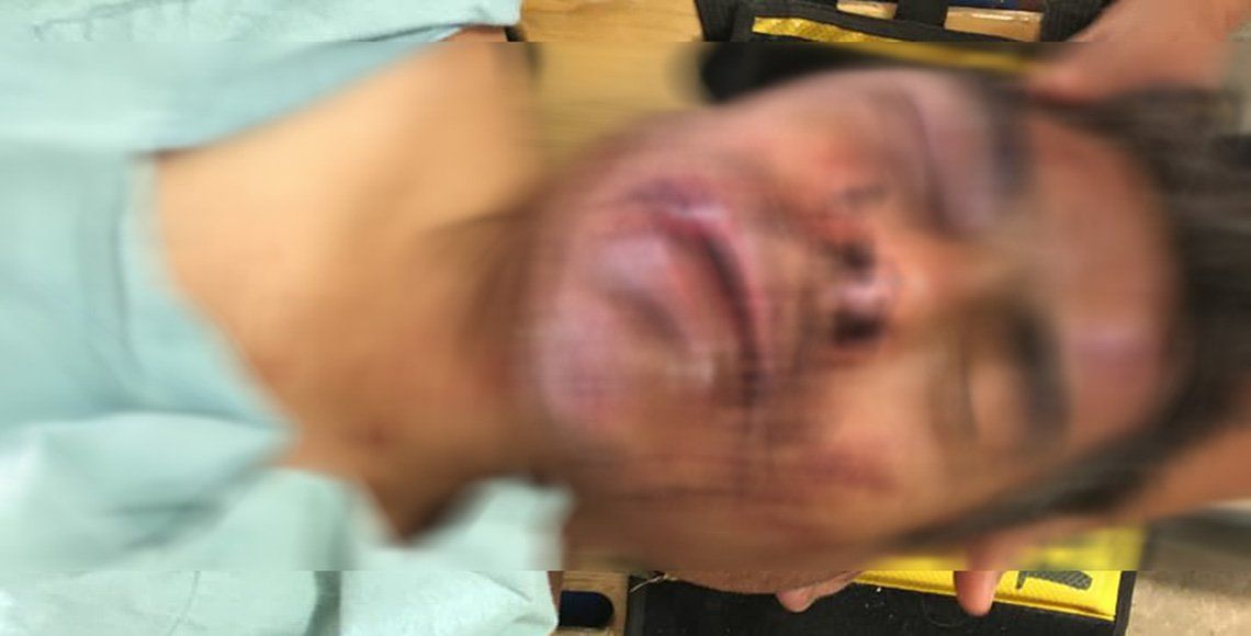 Exempleado de Fiscalía de Chiapas manda al hospital a vigilante tras golpiza - vigilante-chiapas