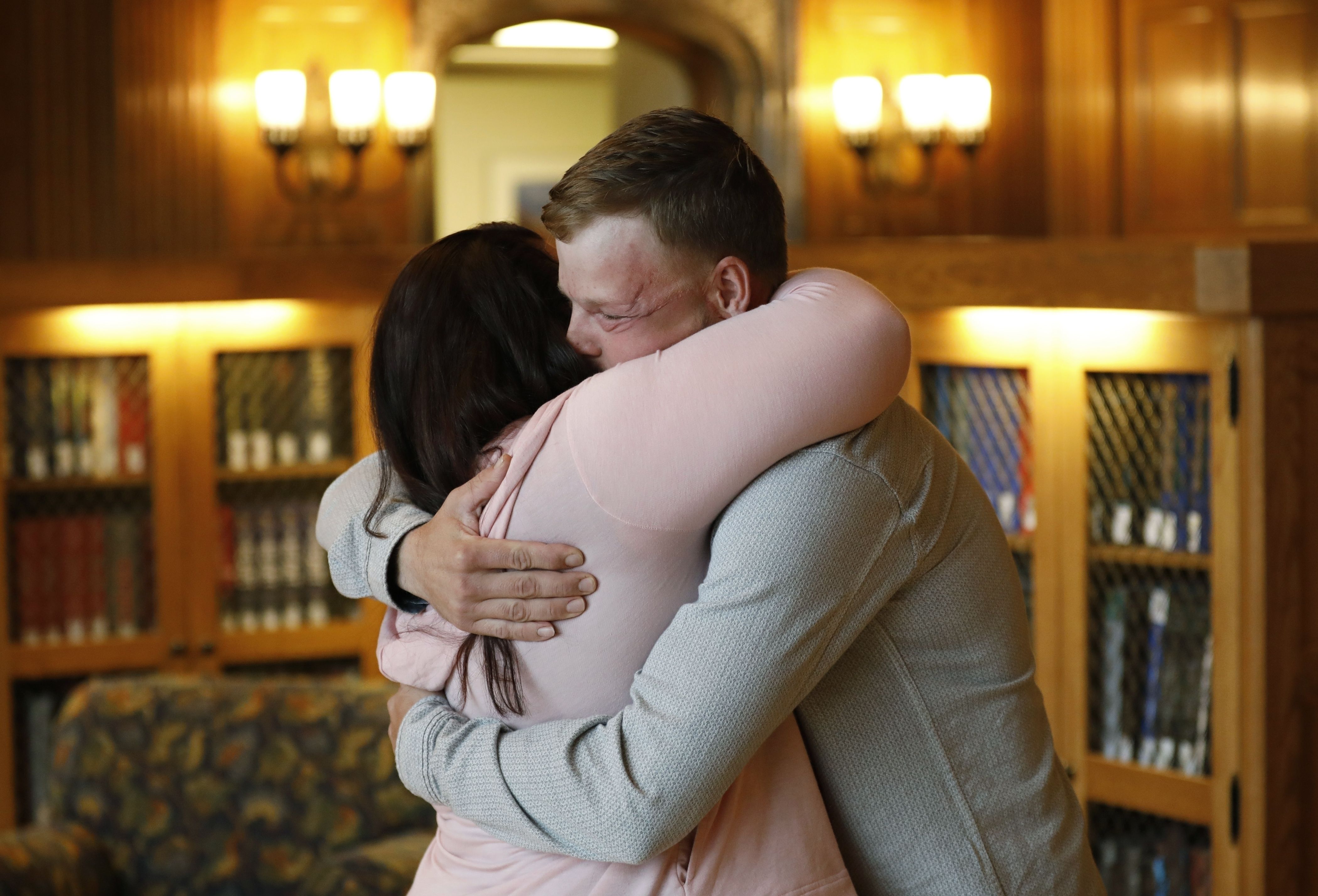 Mujer conoce al hombre al que le fue trasplantado el rostro de su esposo - AP17314568148136