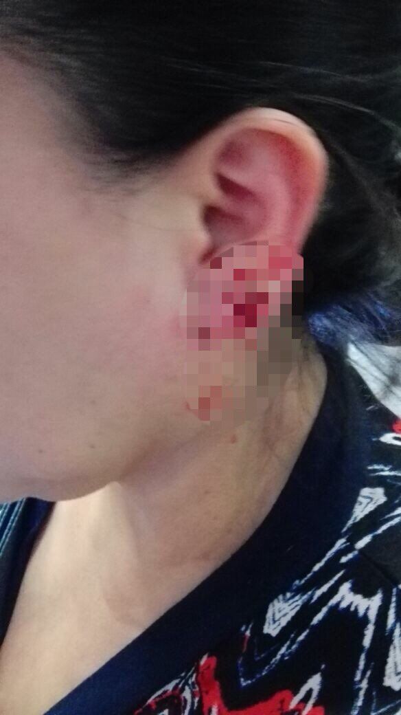 Detienen a hombre que le arrancó aretes a usuaria del Metro - mujer-asalto