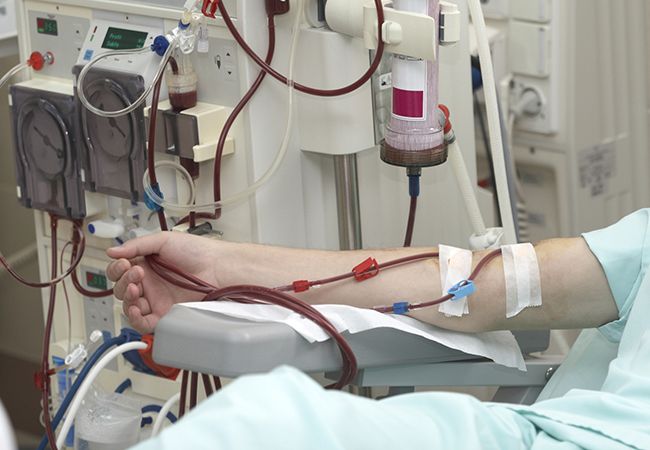 Aumentan casos de Insuficiencia Renal Crónica a nivel mundial