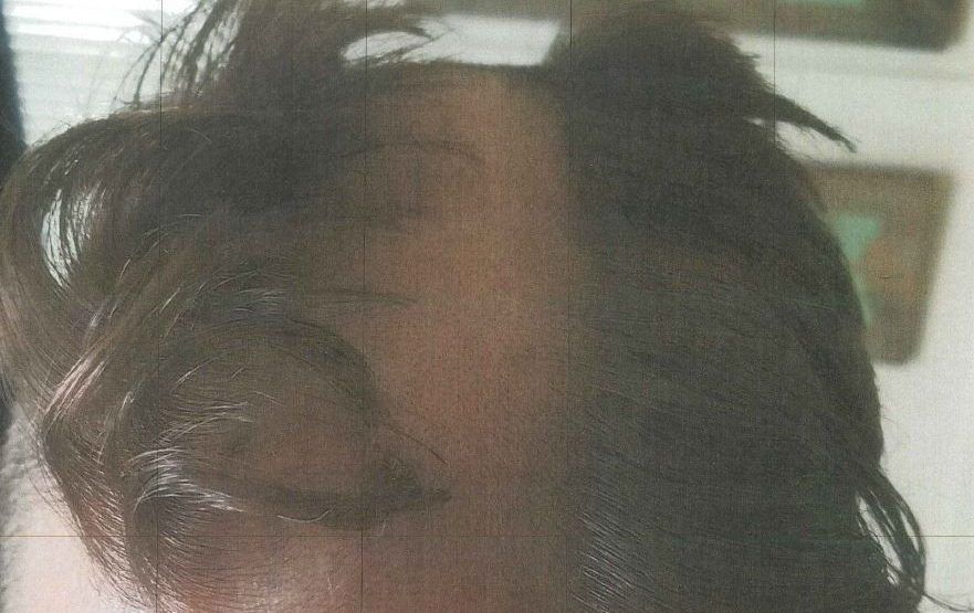 Arrestan a estilista por cortar la oreja de un cliente intencionalmente