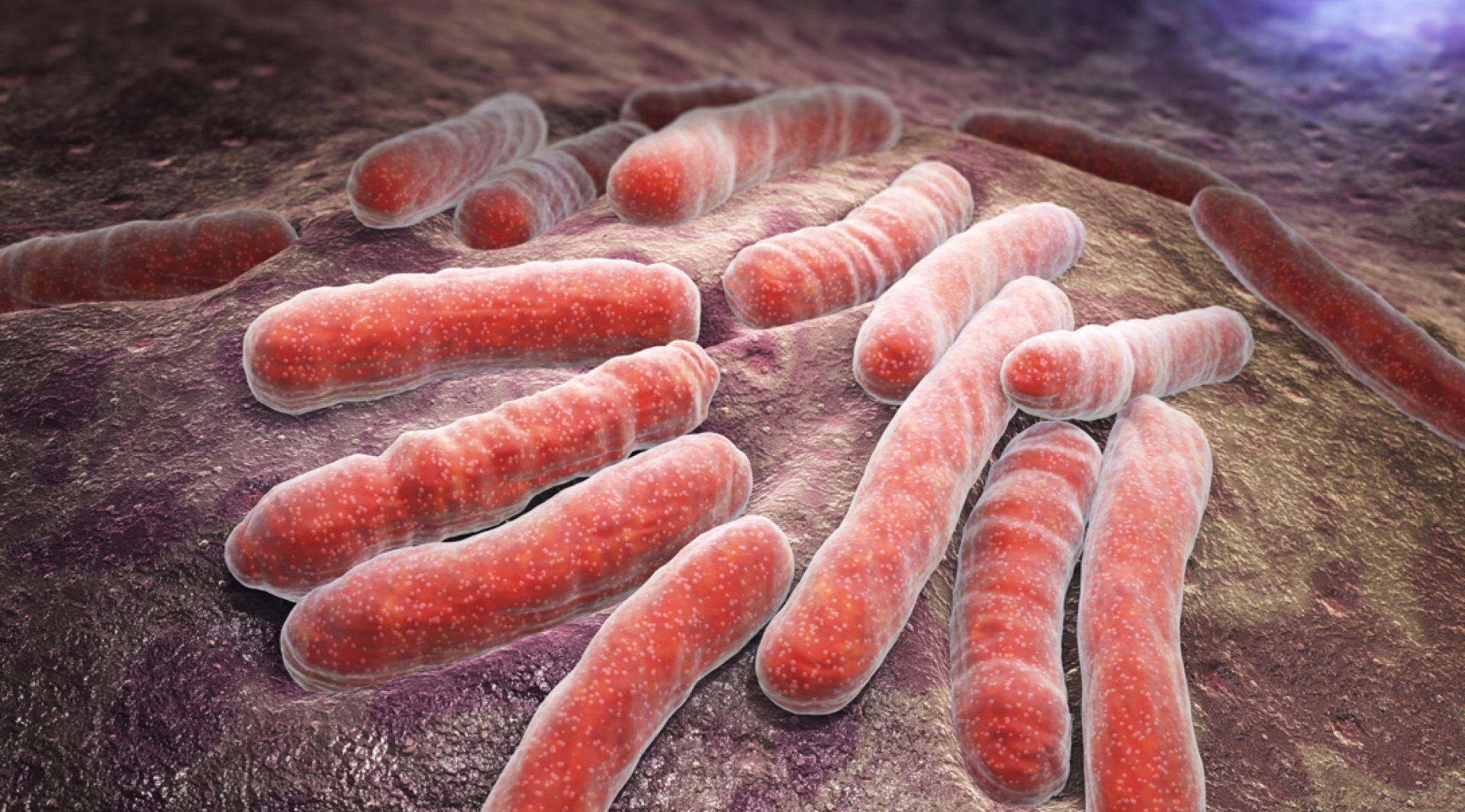 Difunden recomendaciones para prevenir tuberculosis en Chihuahua