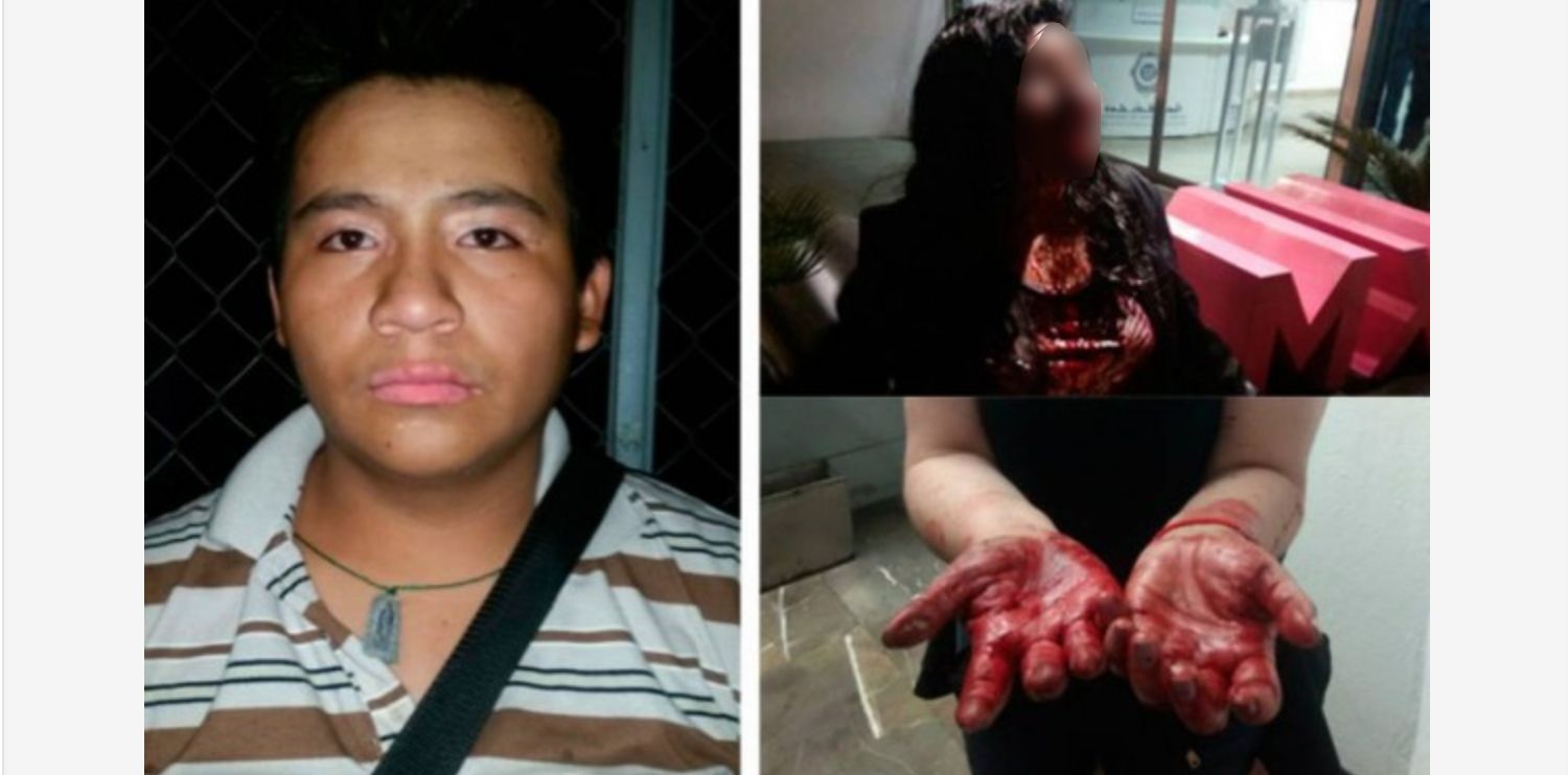 Mujer se opone a atraco y le desfiguran la cara en Metro Tacuba