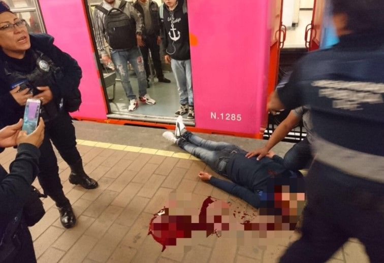 Convoy del Metro golpea a usuario y le abre la cabeza