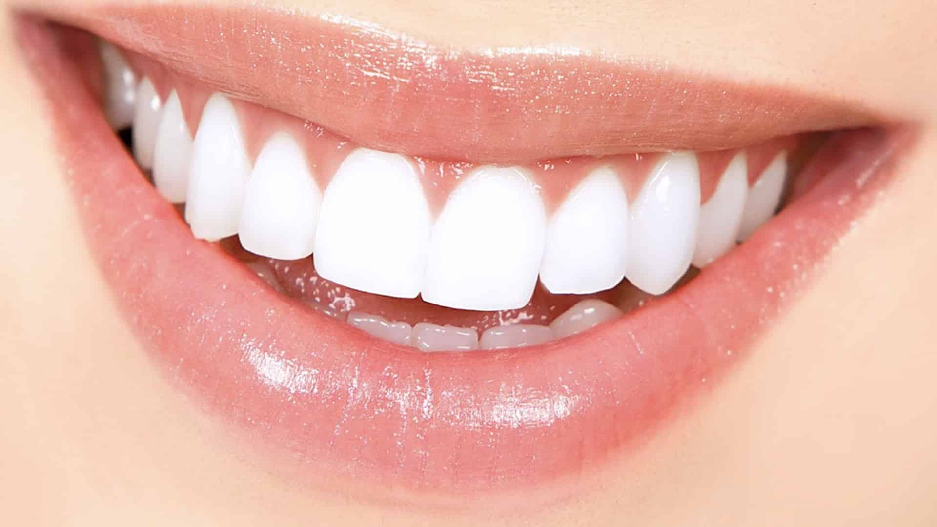 Los riesgos de usar tiras blanqueadoras