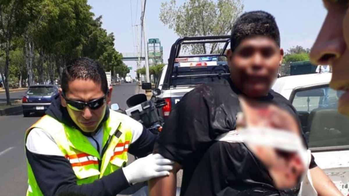 Normalista pierde la mano por explosión de juego pirotécnico