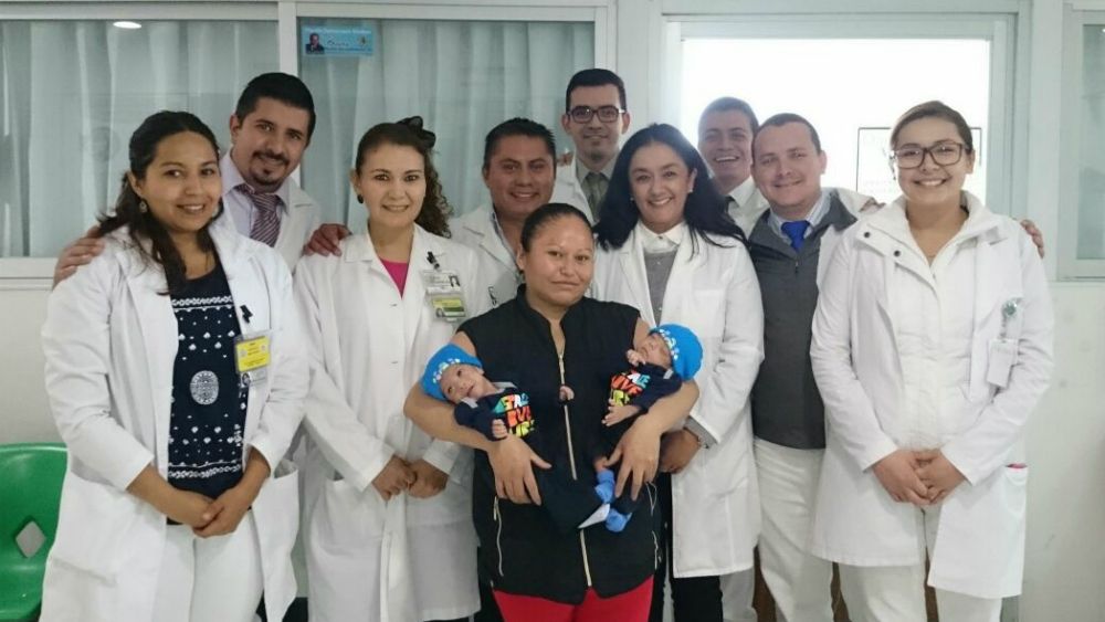 Médicos del IMSS separan con éxito a siameses en León