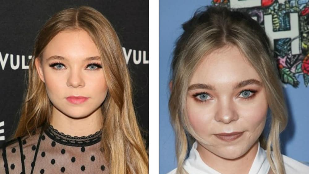 Actriz Taylor Hickson demanda a productora por desfigurarle la cara