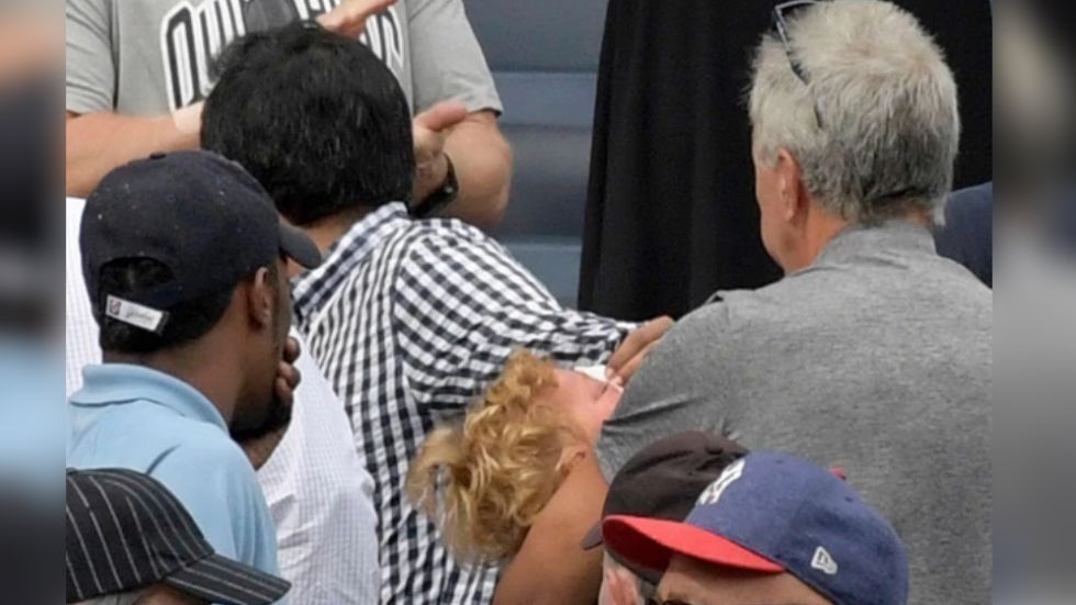 Menor golpeada por bola perdida de los Yankees sigue en recuperación