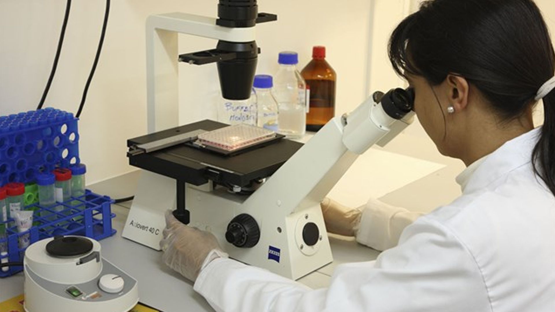 Identifican biomarcador para linfoma cutáneo