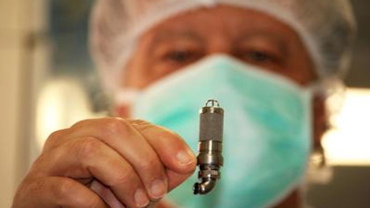 Implantan mini corazón en niña de tres años en Italia