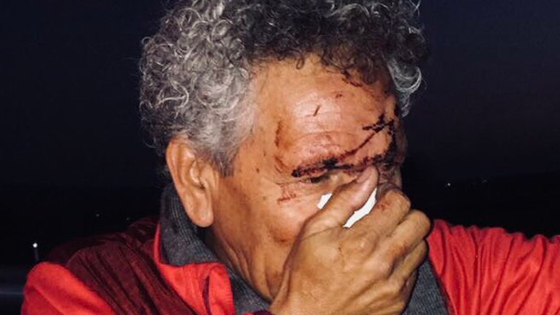 Técnico del Veracruz Premier se encuentra en coma inducido: Fidel Kuri