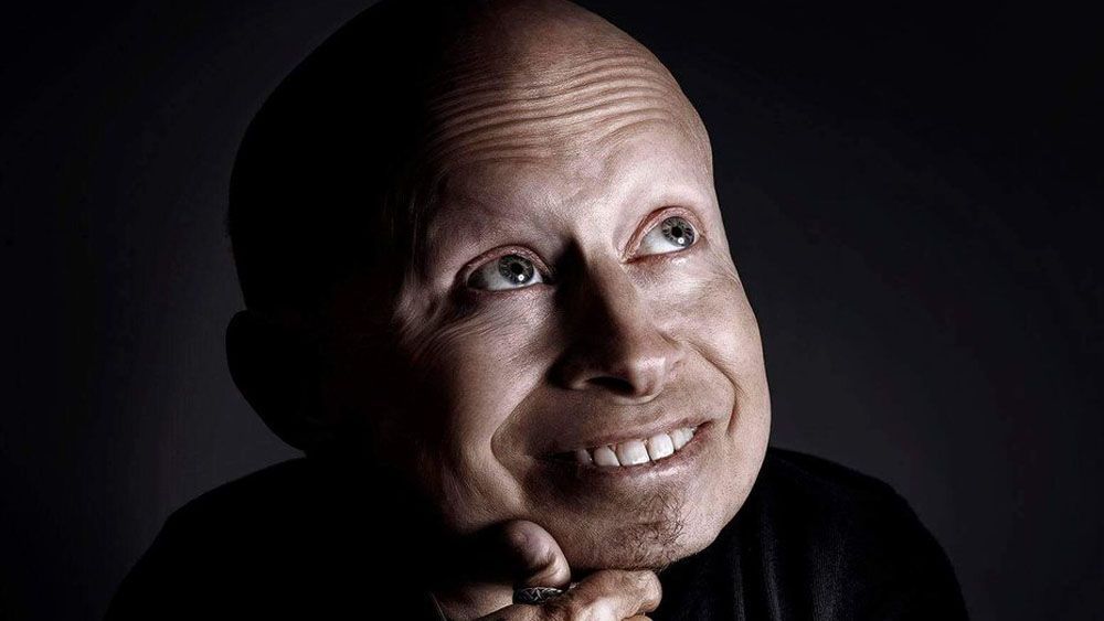 Muere el actor Verne Troyer a los 49 años