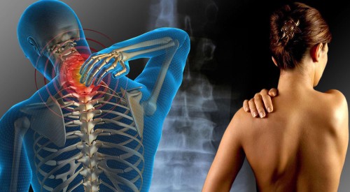 ¿Qué es la higiene en la columna vertebral? - columna-vertebral-2