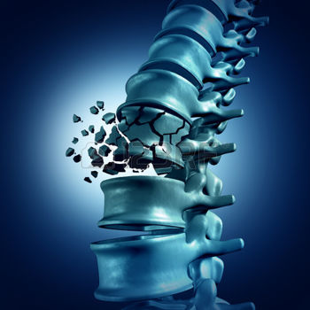 ¿Qué es la higiene en la columna vertebral? - columna-vertebral-3