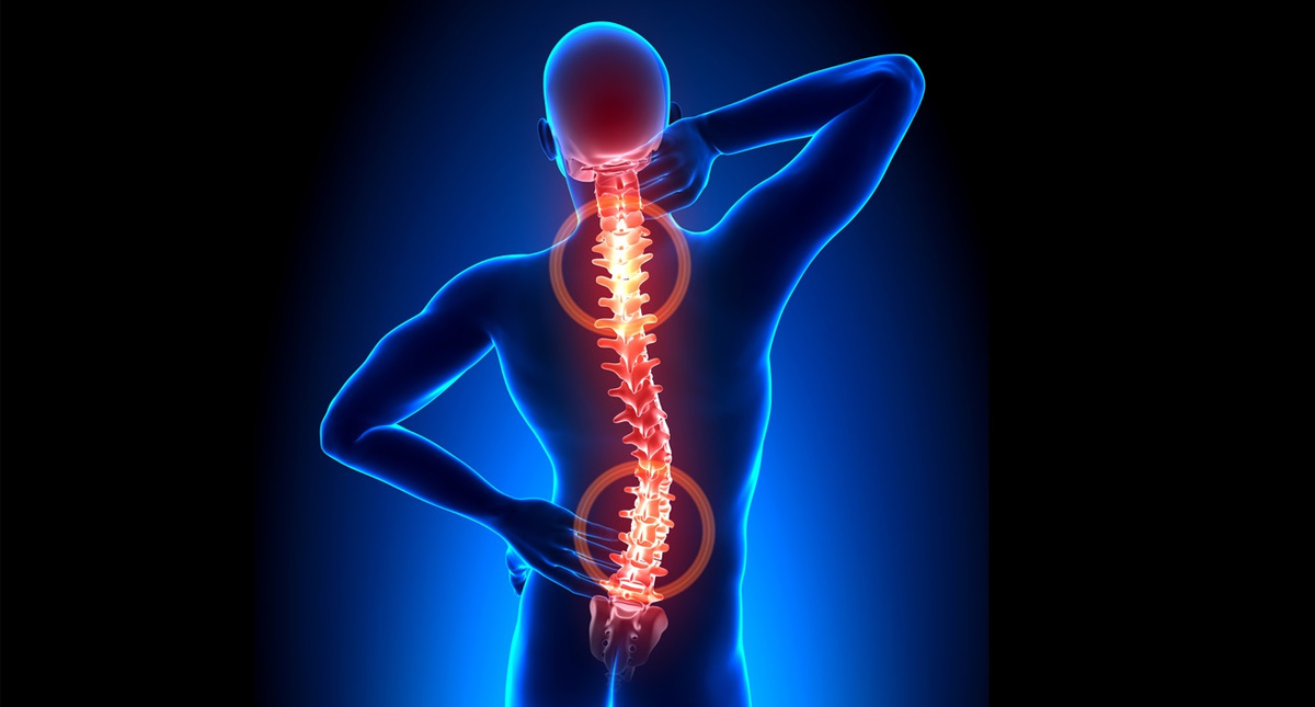 ¿Qué es la higiene en la columna vertebral? ¿Qué es la higiene en la columna vertebral?